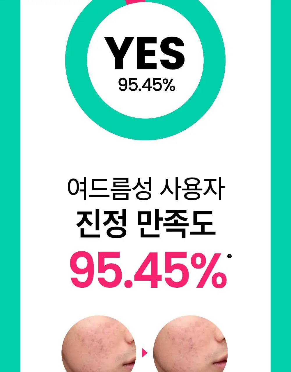 [트러블완화/수분진정] 비플레인 시카테롤 토너 200ml 상세페이지 9
